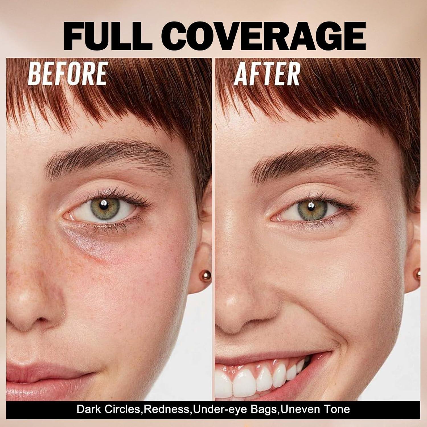 Corrector de Ojeras Anglicolor 12.4 ml - Cobertura Total 03 Medio