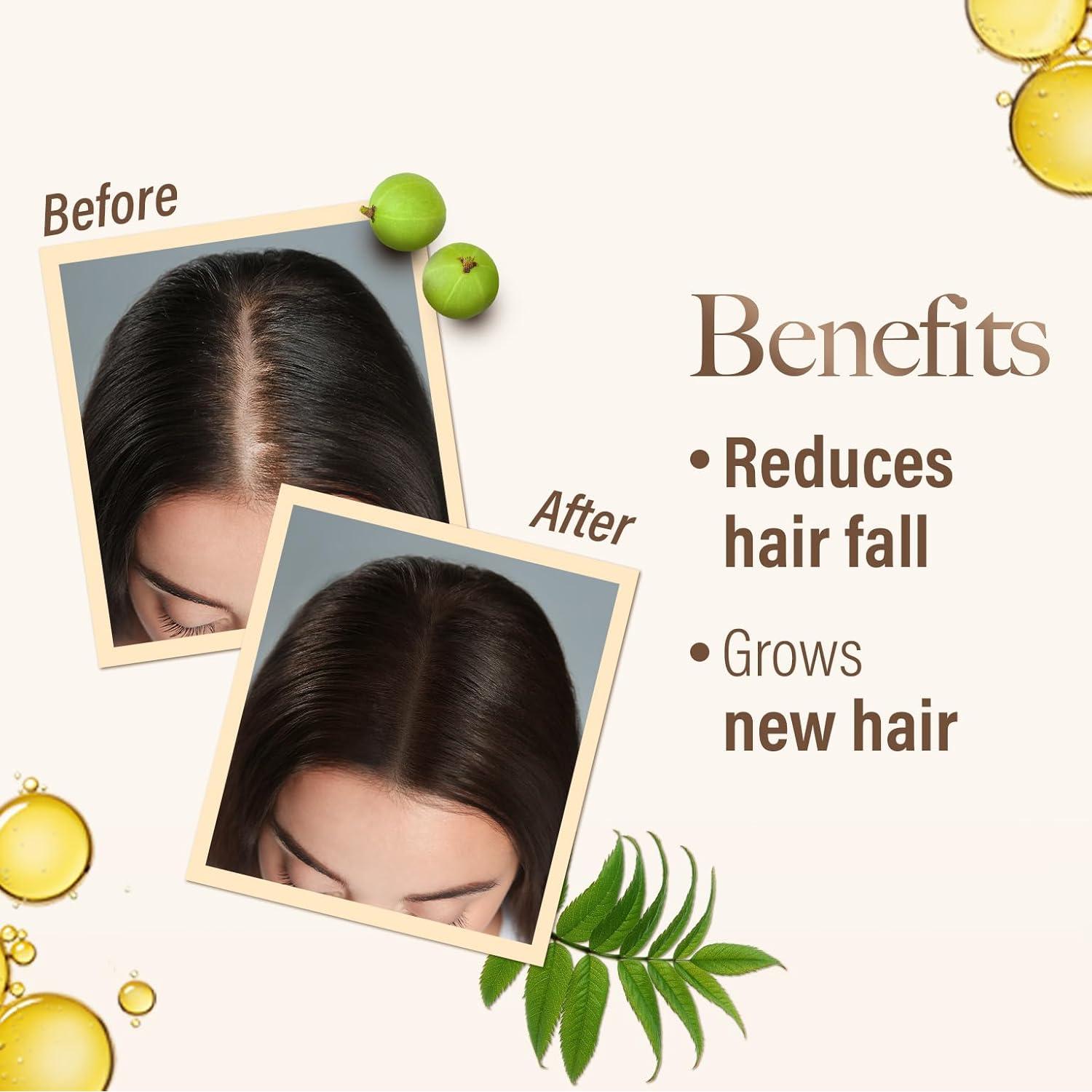 Aceite Capilar Ayurvédico Kesh King 300ml - Crecimiento y Fortalecimiento