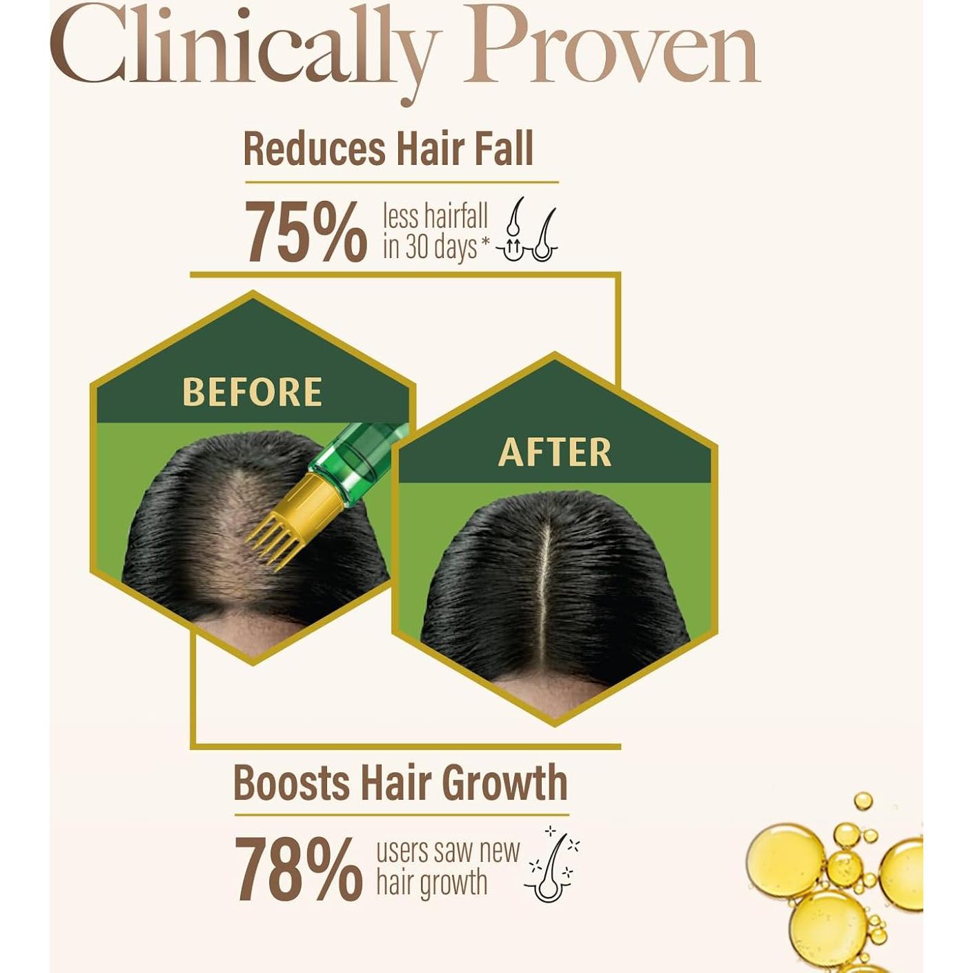 Aceite Capilar Ayurvédico Kesh King 100ml - Bhringraj y Amla