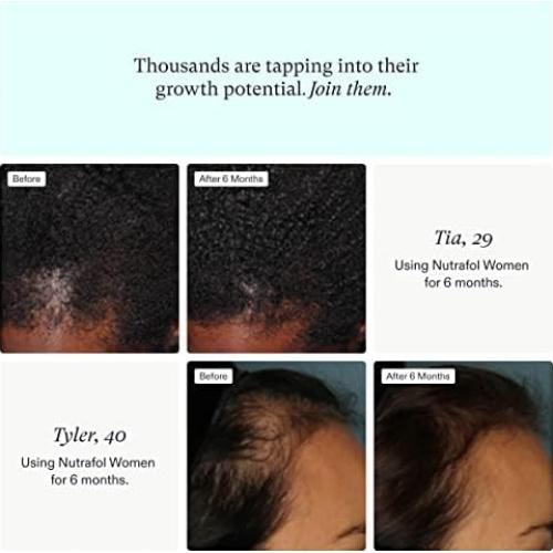 Suplemento Crecimiento Cabello Nutrafol Mujeres 2 Meses
