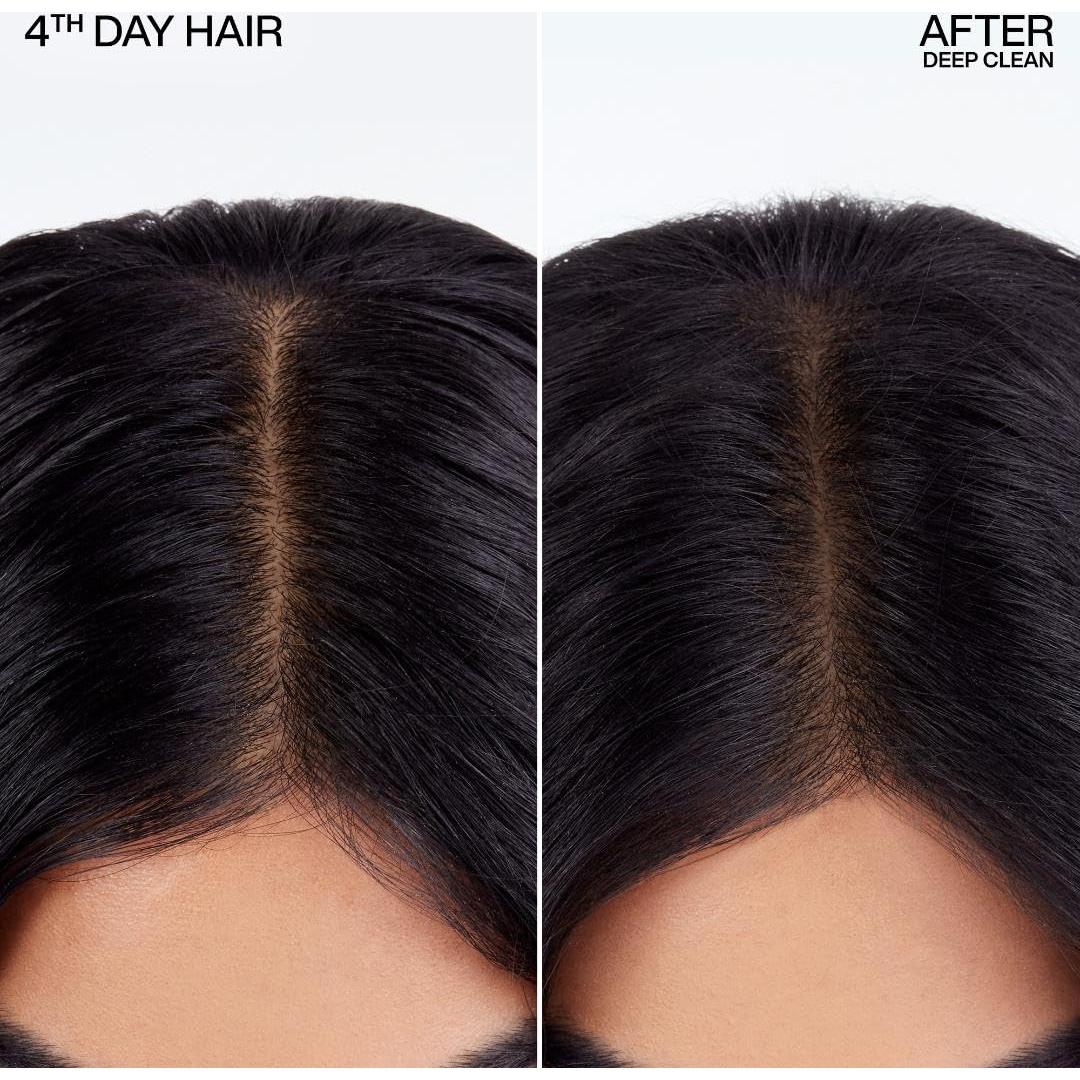 Champú Seco Redken Deep Clean 272g - Absorbe Aceite y Refresca