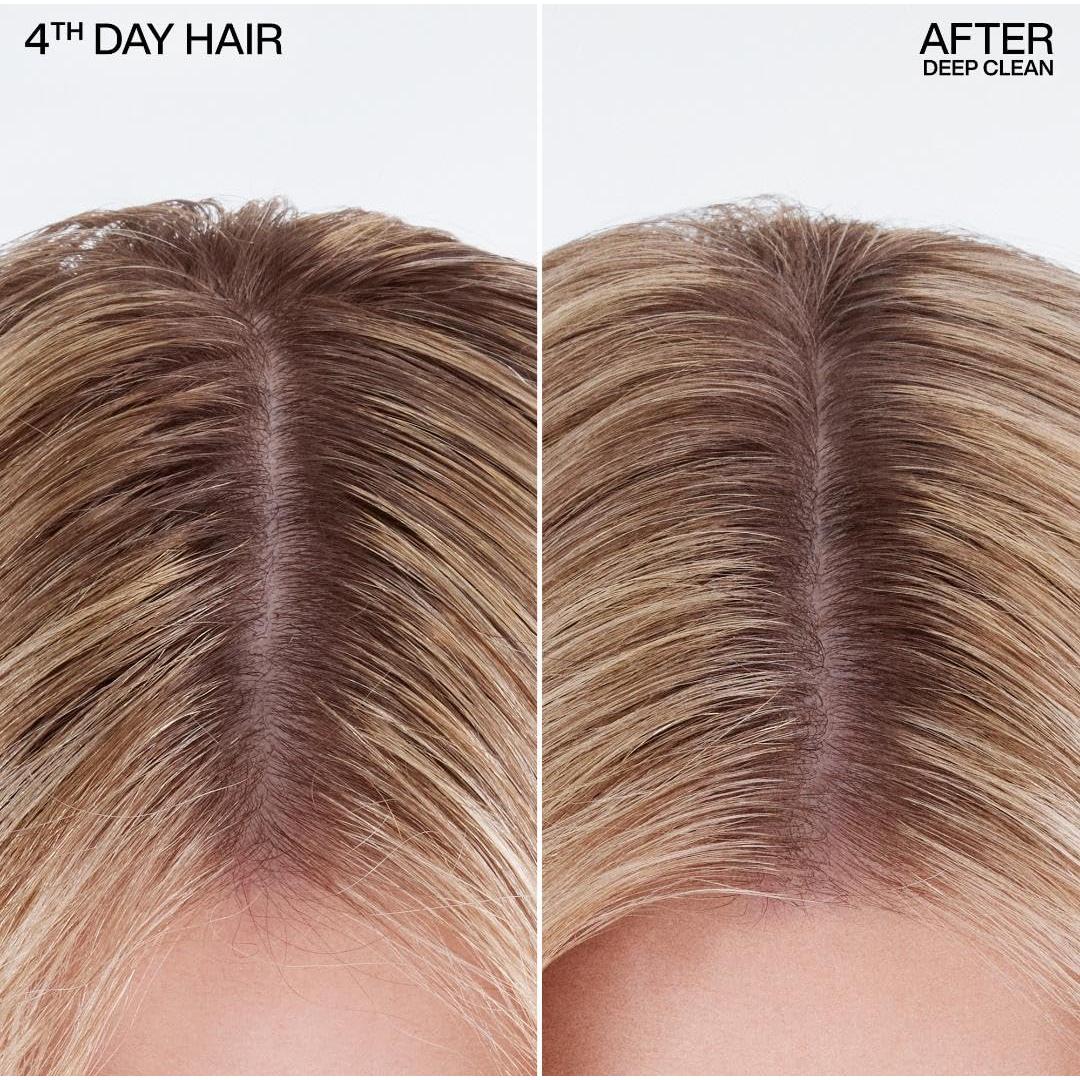 Champú Seco Redken Deep Clean 272g - Absorbe Aceite y Refresca