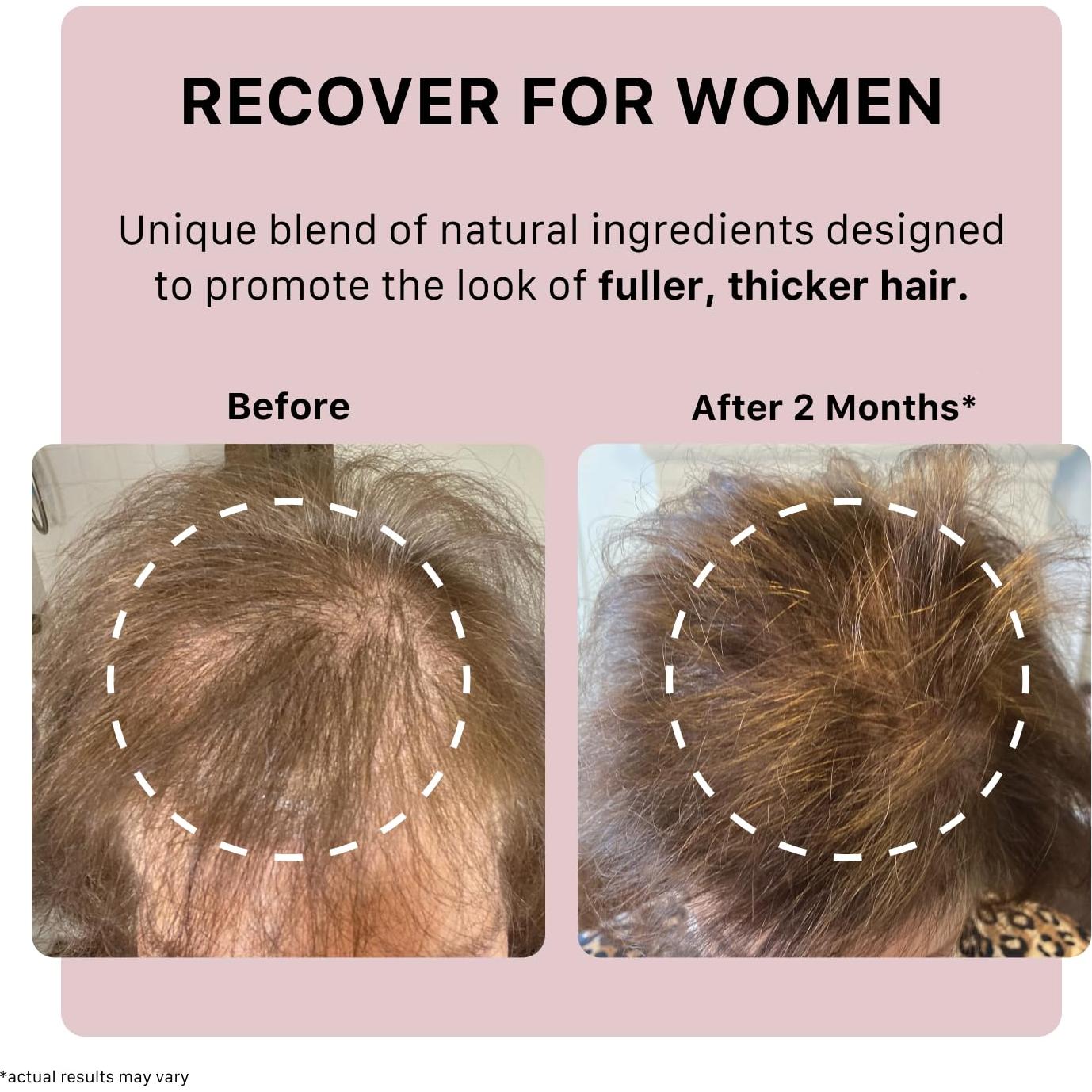 Champú Engrosante ACTIIV para Mujeres 79.83 ml - Vegano