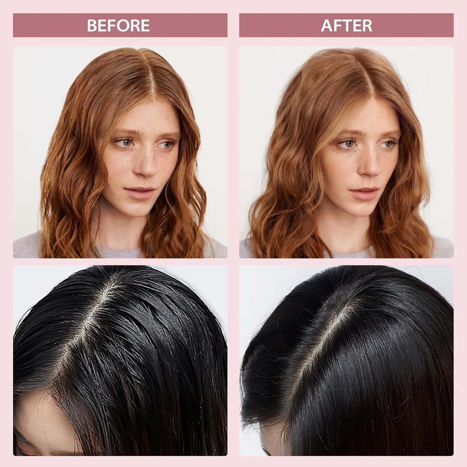 Polvo de Champú Seco YLNALO 16.43g - Sin Residuo Blanco