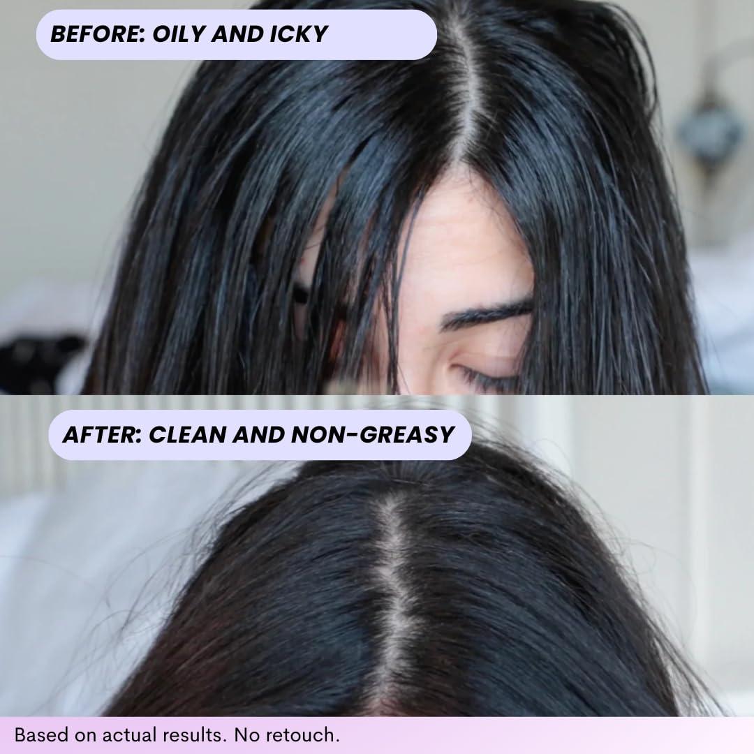 Champú Seco FoxyBae Turned Up 198.4g - Voluminizador con Biotina