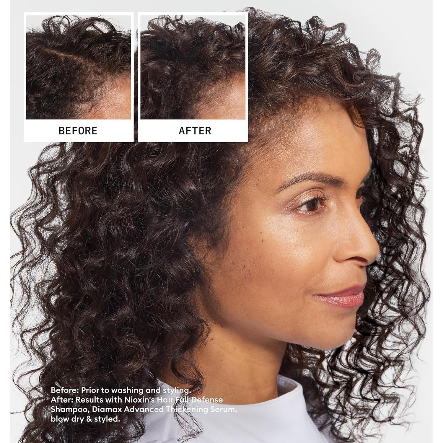 Champú Nioxin Defensa Caída Cabello Set 2 Piezas 473ml + 68ml