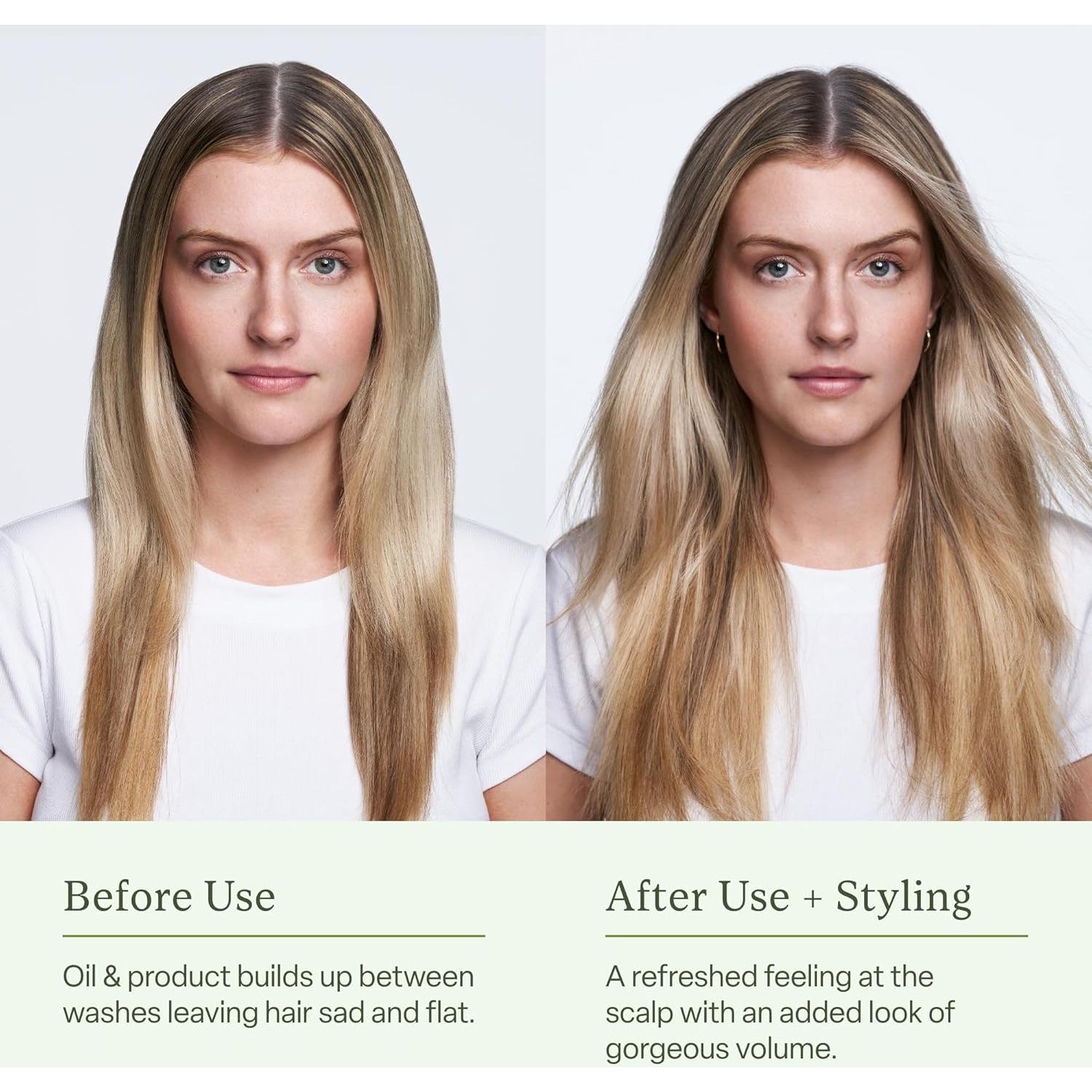 Champú Seco Divi 150g - Absorbe Aceite y Equilibra Cuero Cabelludo