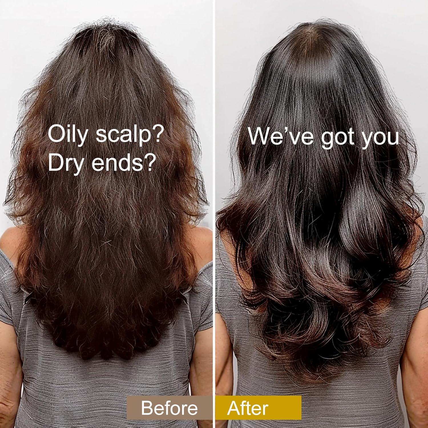 Aceite de Romero y Ricino SAPHUS 29.57 ml - Nutritivo y Voluminizador