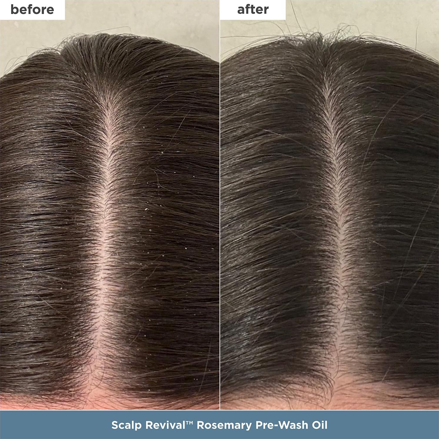 Kit de Cuidado Capilar Briogeo - Reparación Cuero Cabelludo y Cabello