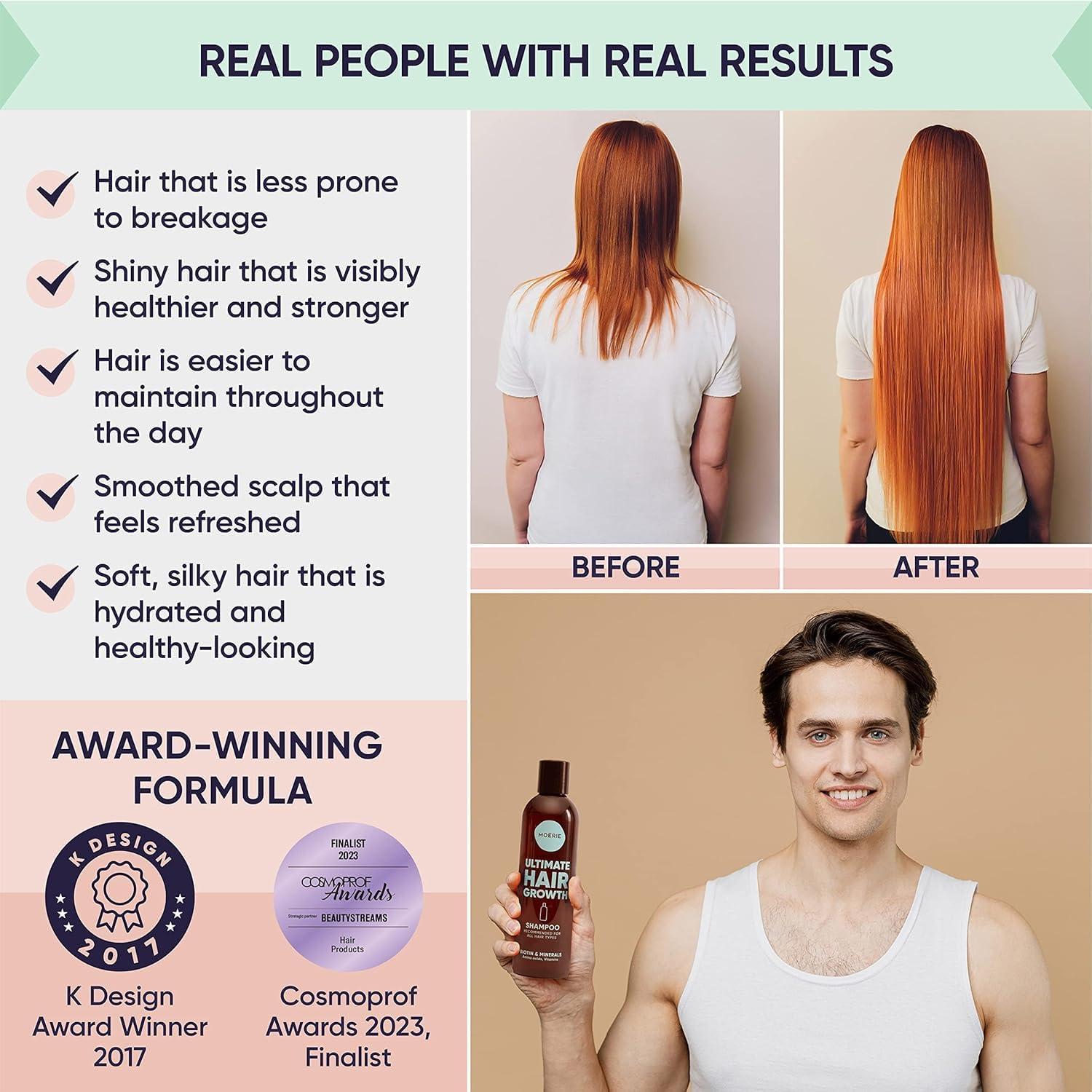 Champú Moerie 250ml para Crecimiento Cabello Fino y Grueso