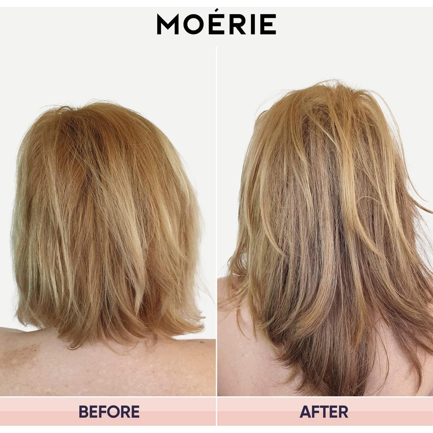 Champú Moerie 250ml para Crecimiento Cabello Fino y Grueso