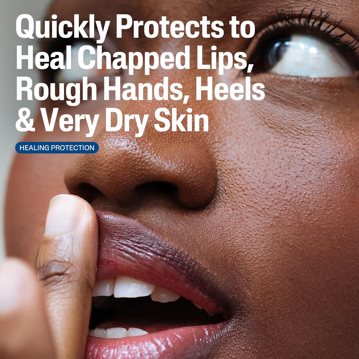 Ungüento Curativo Cetaphil 340 g para Piel Seca e Irritada