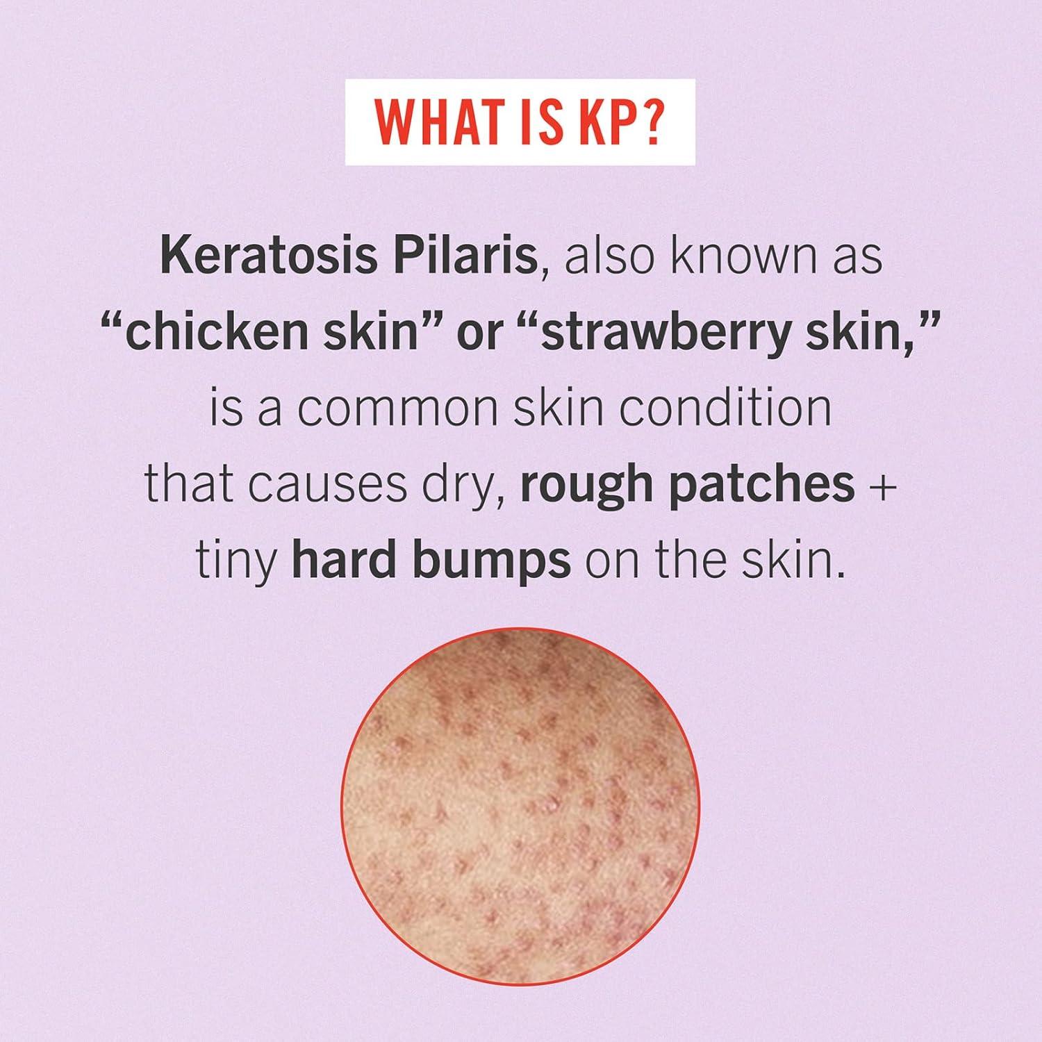 Set de Tratamiento Exfoliante First Aid Beauty - 3 Piezas