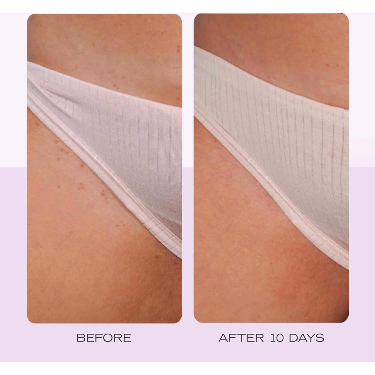 Exfoliante Corporal Jumbo First Aid Beauty 283g + Almohadillas 60 Ct