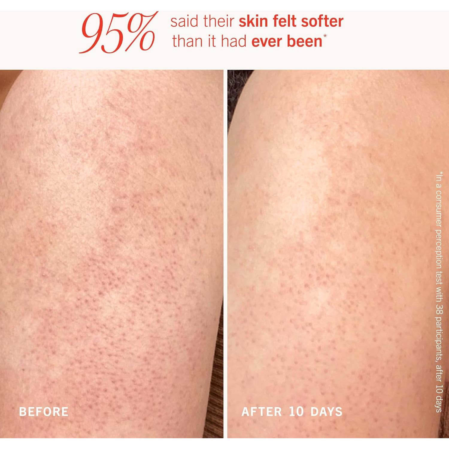 Kit Exfoliante Corporal Suave First Aid Beauty 56.7g AHA