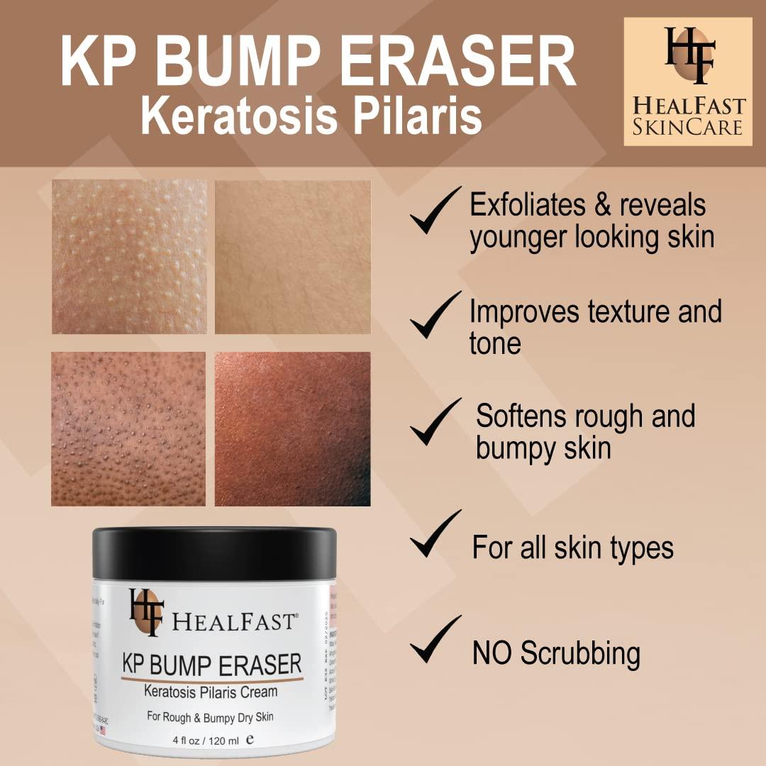Crema Bump Eraser Healfast 140 g - Exfoliante para Queratosis Pilaris