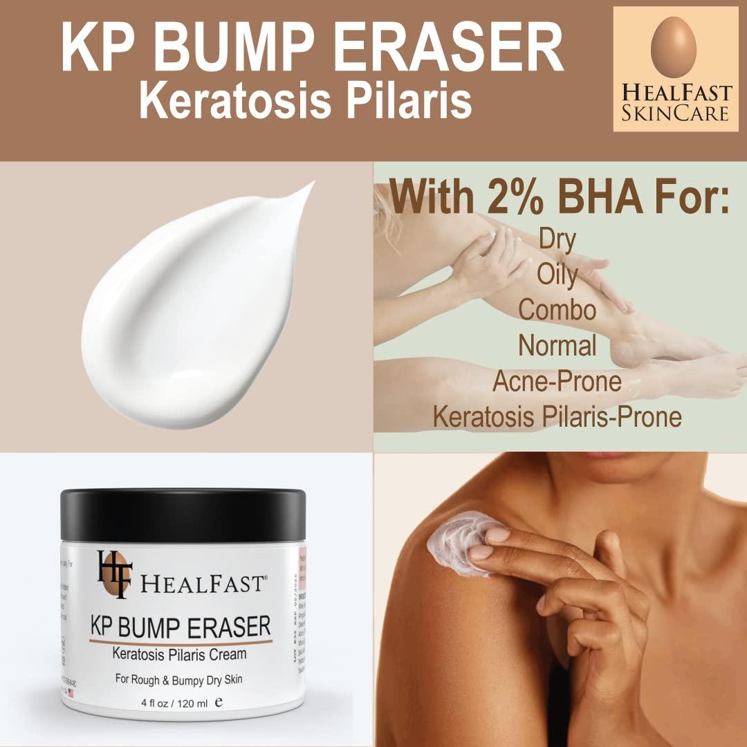 Crema Bump Eraser Healfast 140 g - Exfoliante para Queratosis Pilaris
