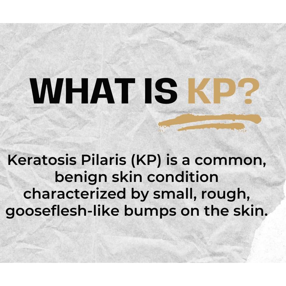 Crema Exfoliante KP Areton 50g - Ácido Salicilico y Niacinamida