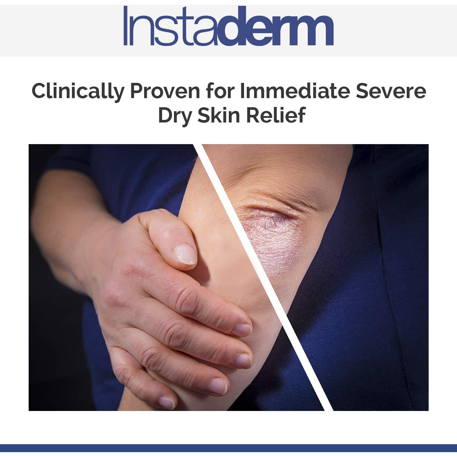 Loción Exfoliante Hidratante Instaderm para Queratosis Pilaris 260g