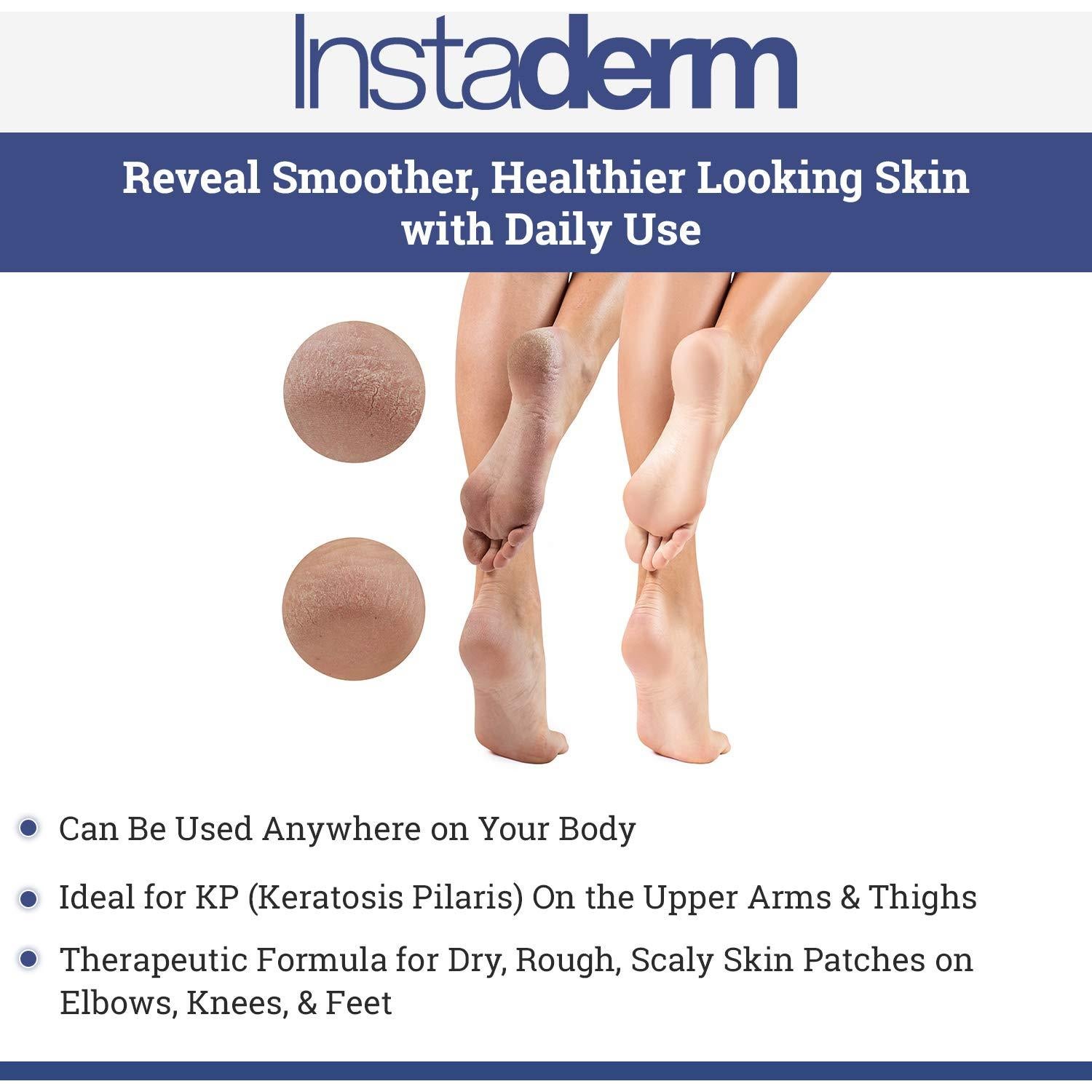 Loción Exfoliante Hidratante Instaderm para Queratosis Pilaris 260g