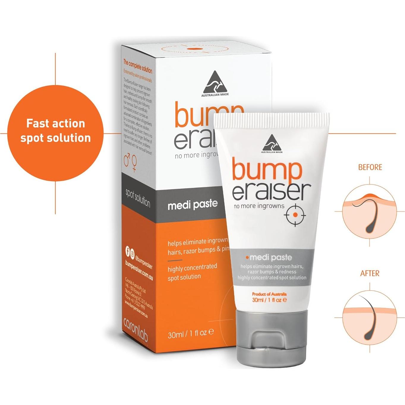 Pasta Medi Bump eRaiser 30g para vellos encarnados y bultos