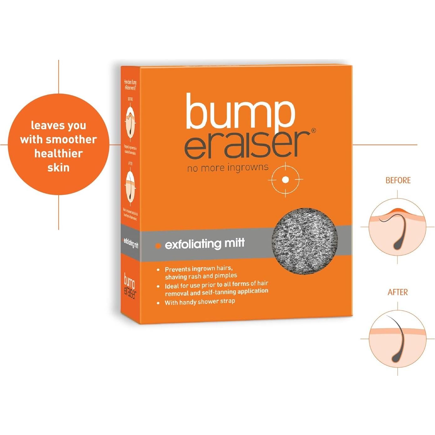 Mitón Exfoliante Bump eRaiser para Vellos Encarnados 12x8cm