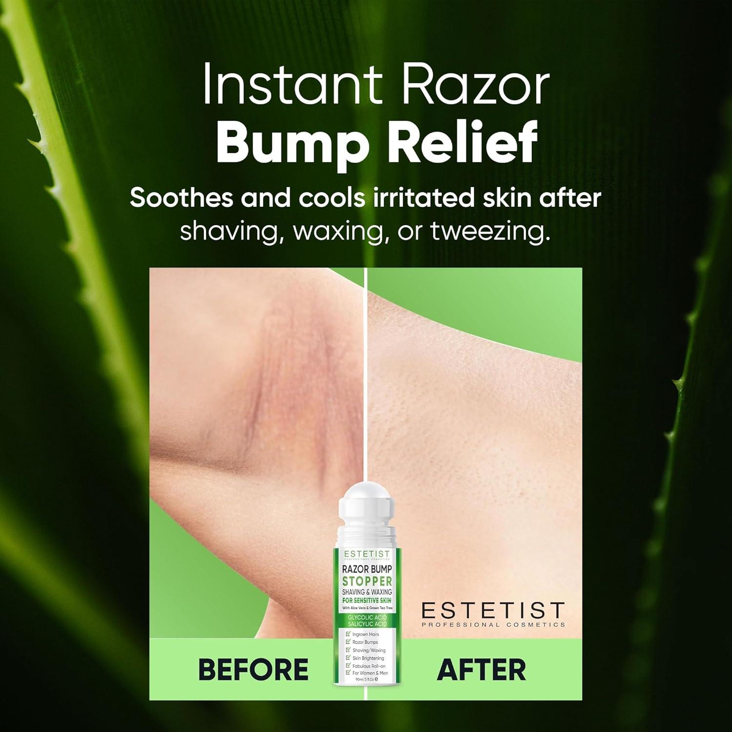 Detenedor de Bultos de Afeitar Estetist Roll-On 85g Aloe Vera