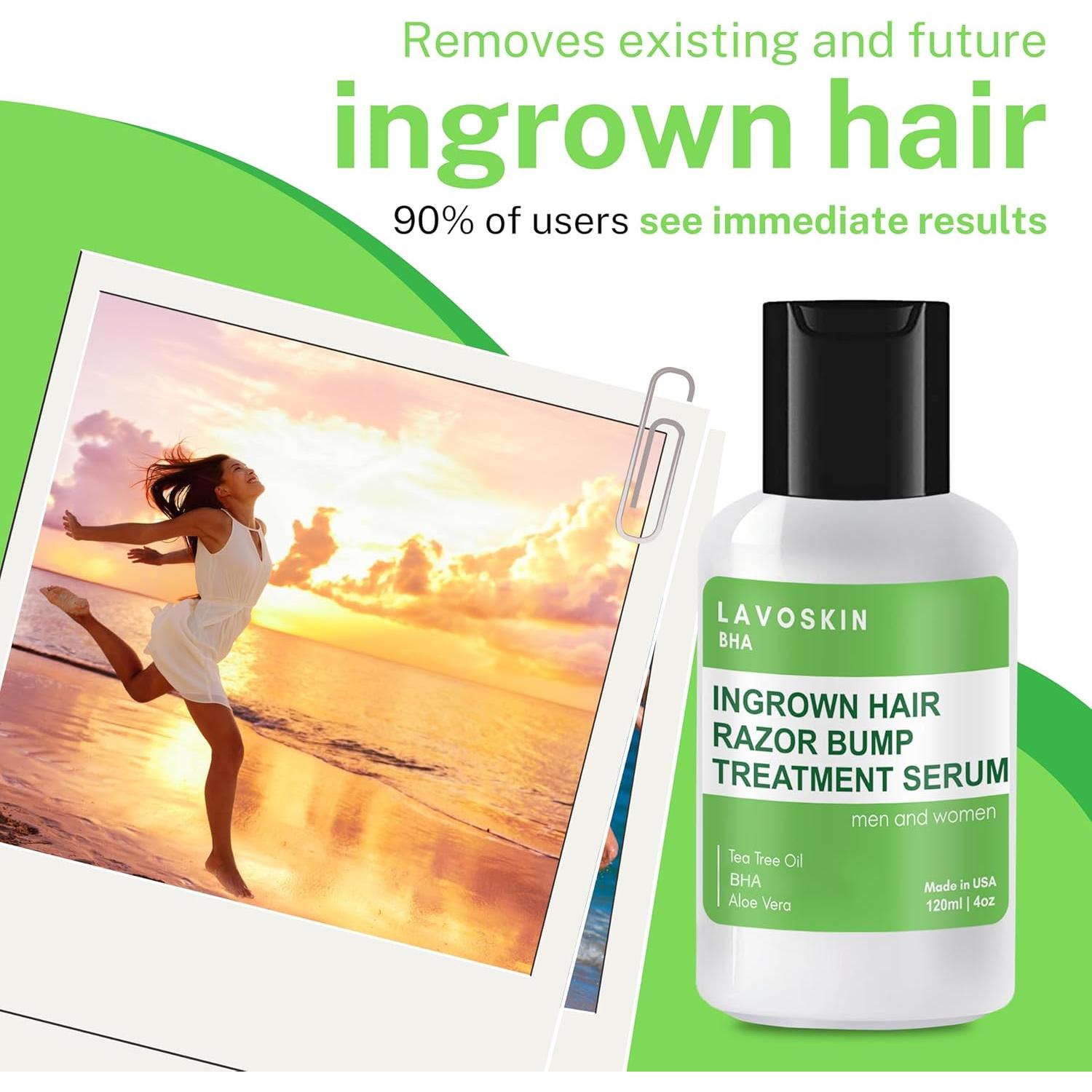 Gel de Árbol de Té LAVO con Ácido Salicílico 230g - Alivio Vellos Encarnados