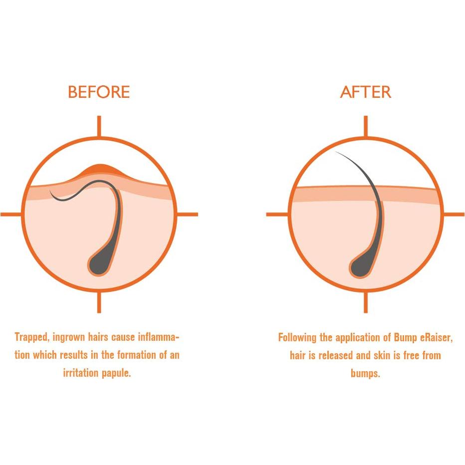 Loción Calmante Bump eRaiser 125g para Vellos Encarnados