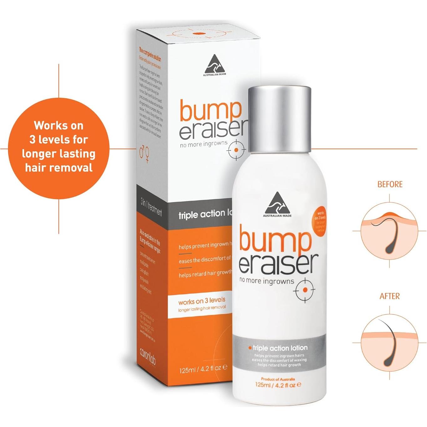 Loción Calmante Bump eRaiser 125g para Vellos Encarnados