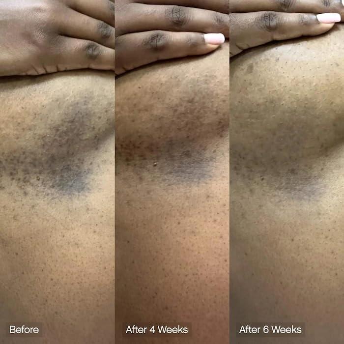 Barra Limpiadora Facial y Corporal Vegana | Ácido Kójico, Vitamina C