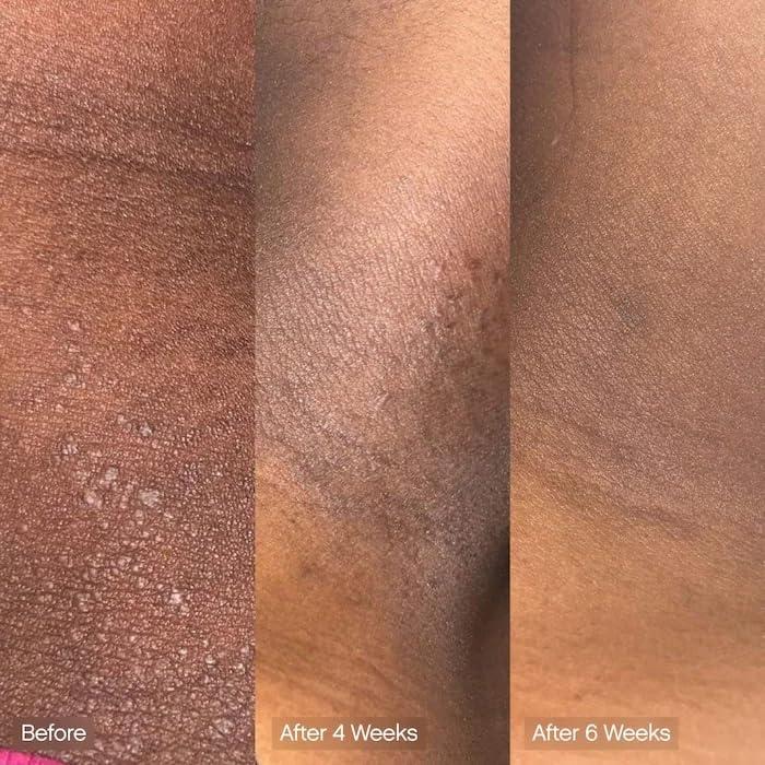 Barra Limpiadora Facial y Corporal Vegana | Ácido Kójico, Vitamina C