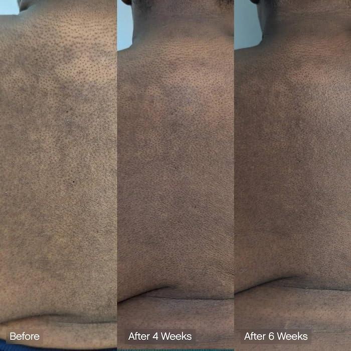 Barra Limpiadora Facial y Corporal Vegana | Ácido Kójico, Vitamina C