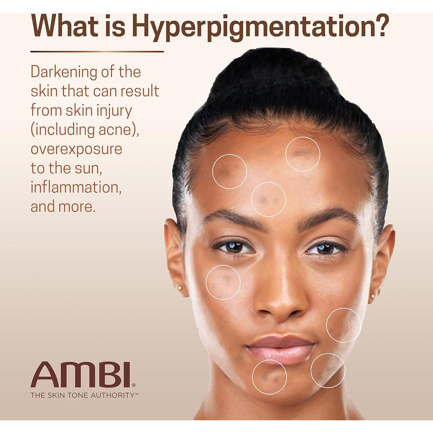 Suero Corrector de Manchas Oscuras Ambi Even & Clear 29.57 ml