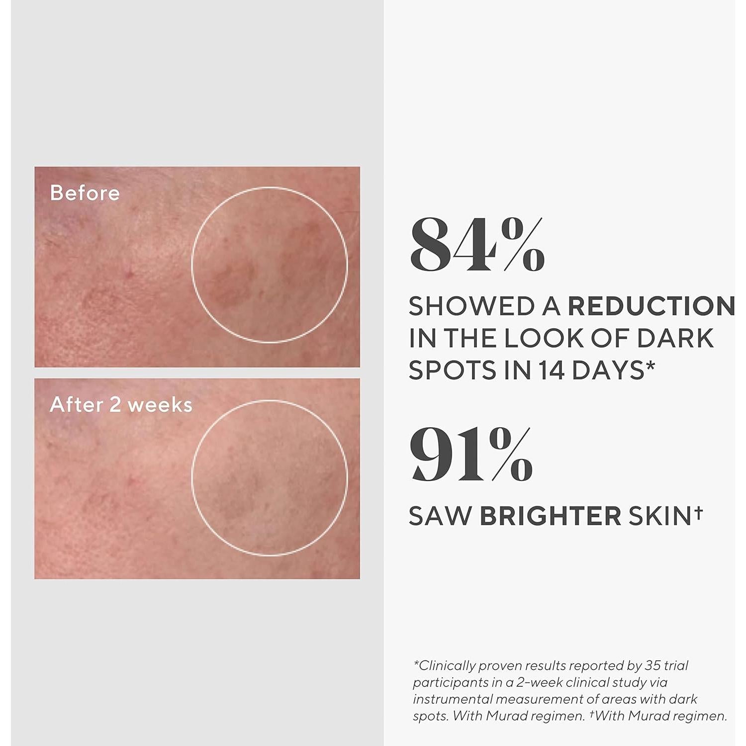 Suero Facial Iluminador Murad 9.8ml - Corrector de Manchas Oscuras