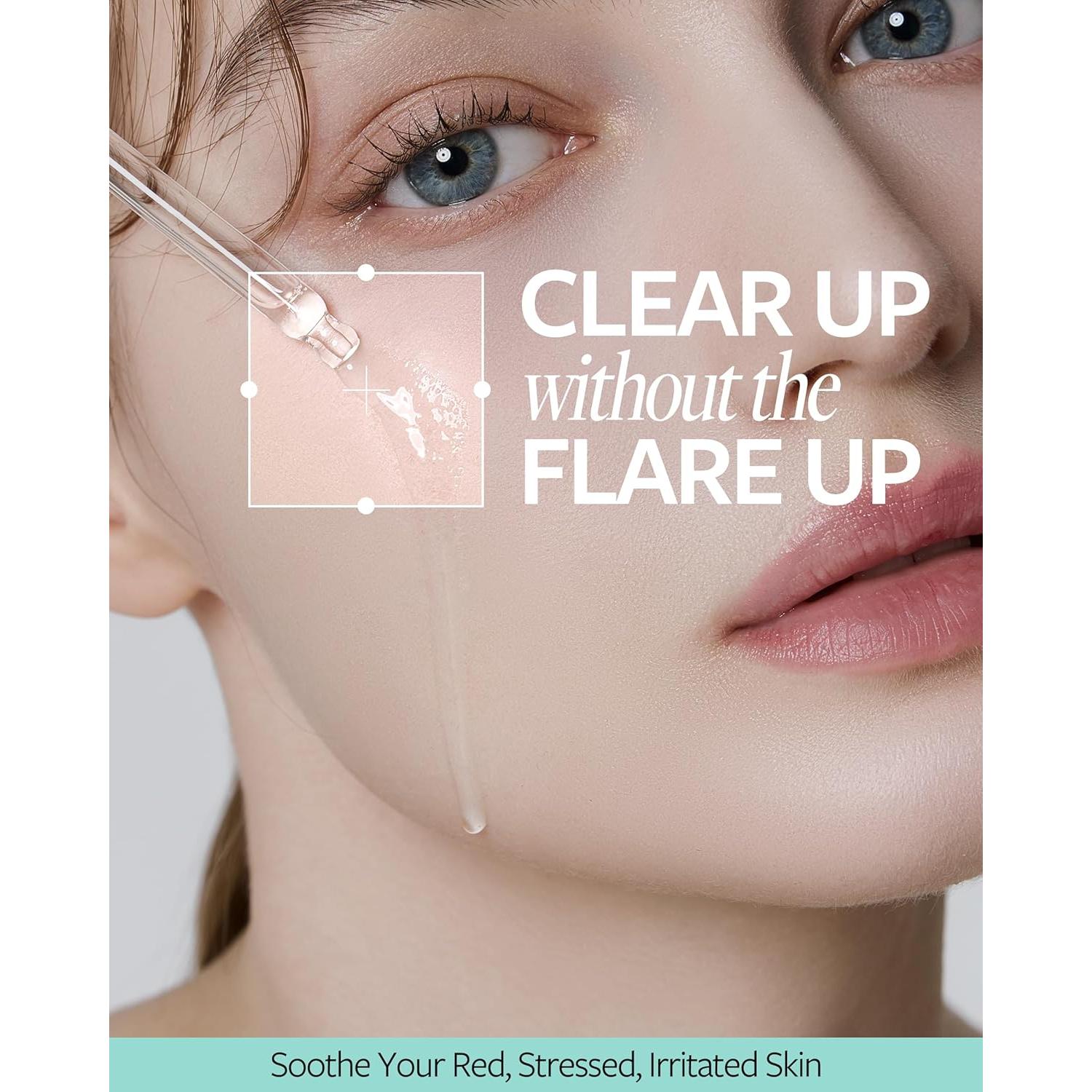 Suero Facial Calmante Ácido Azelaico 10% - 30 ml - COSMAX