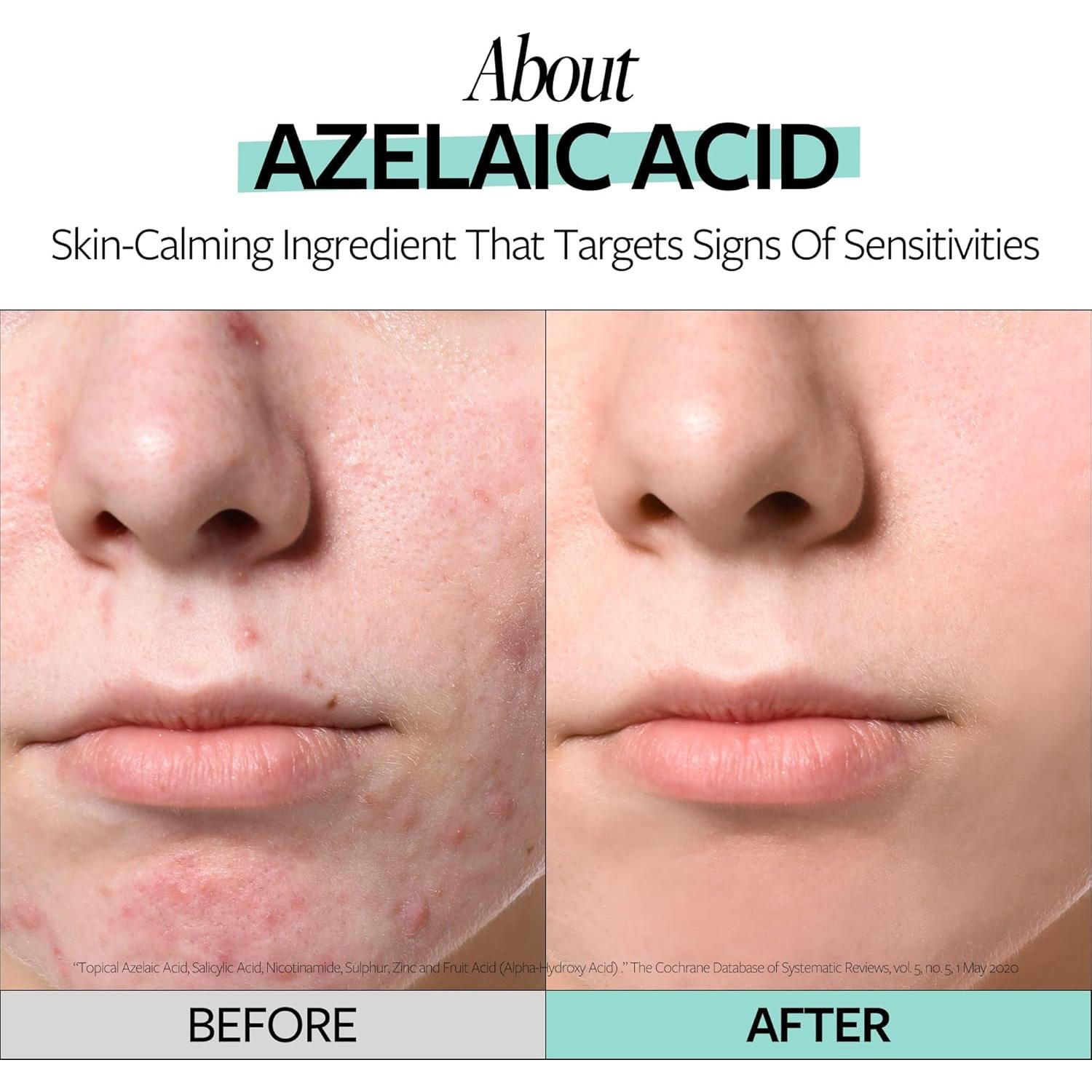 Suero Facial Calmante Ácido Azelaico 10% - 30 ml - COSMAX