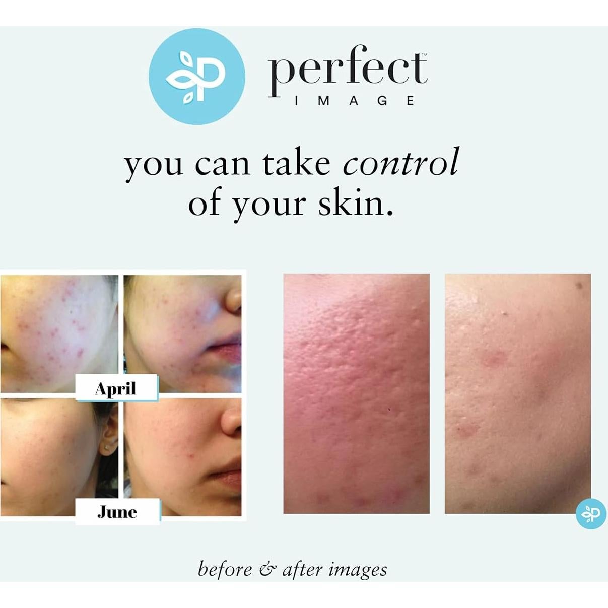 Peeling Químico Lactic 50% Imagen Perfecta 30 mL - Exfoliante Facial