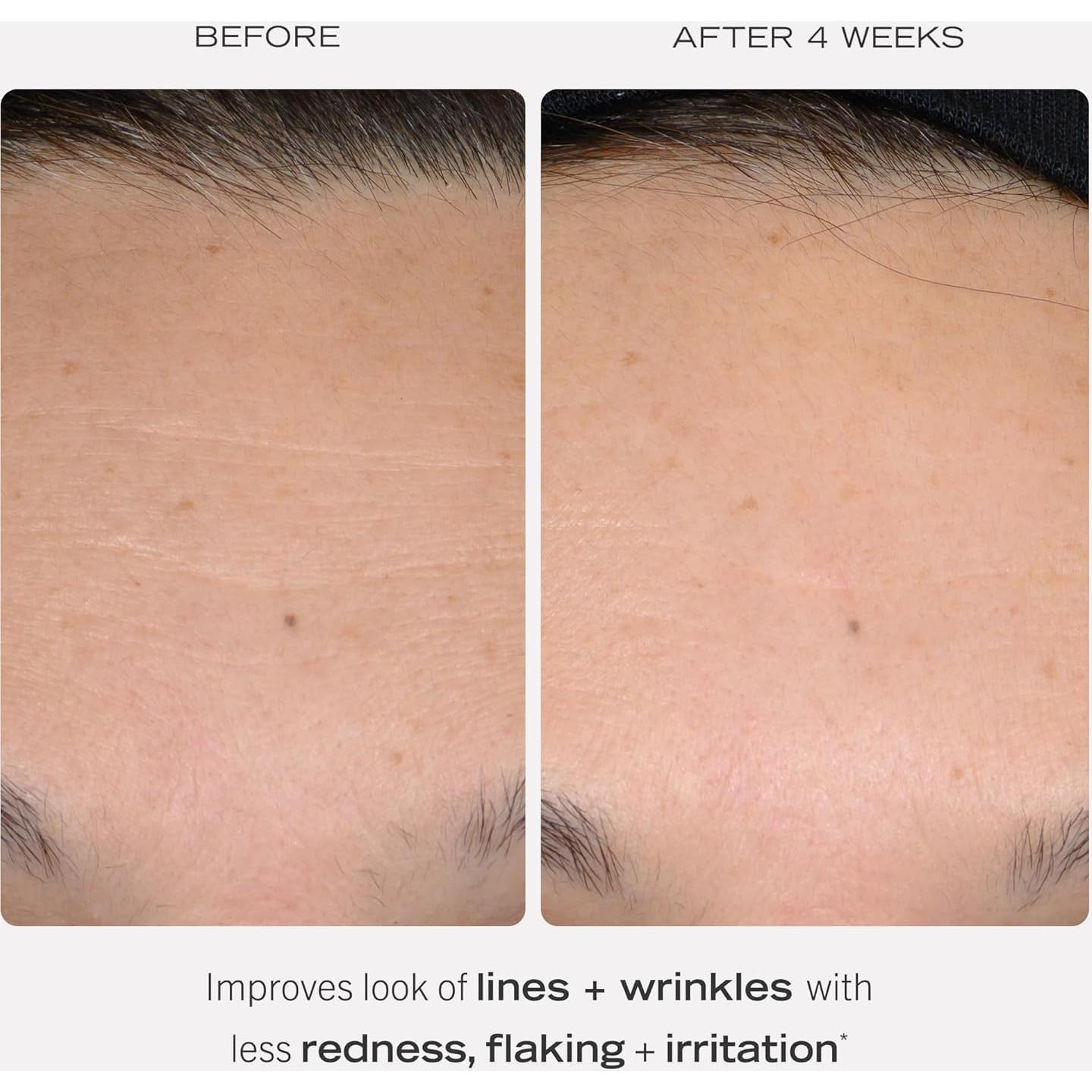 Suero Retinol 0.3% First Aid Beauty 28.35 ml Piel Sensible