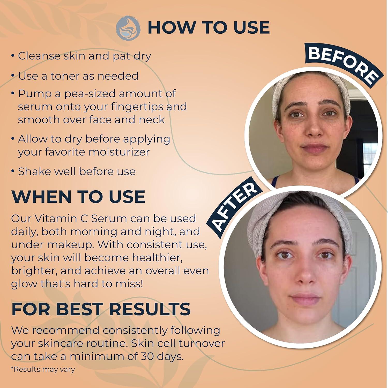 Suero Facial de Vitamina C Foxbrim 30ml - Natural y Orgánico