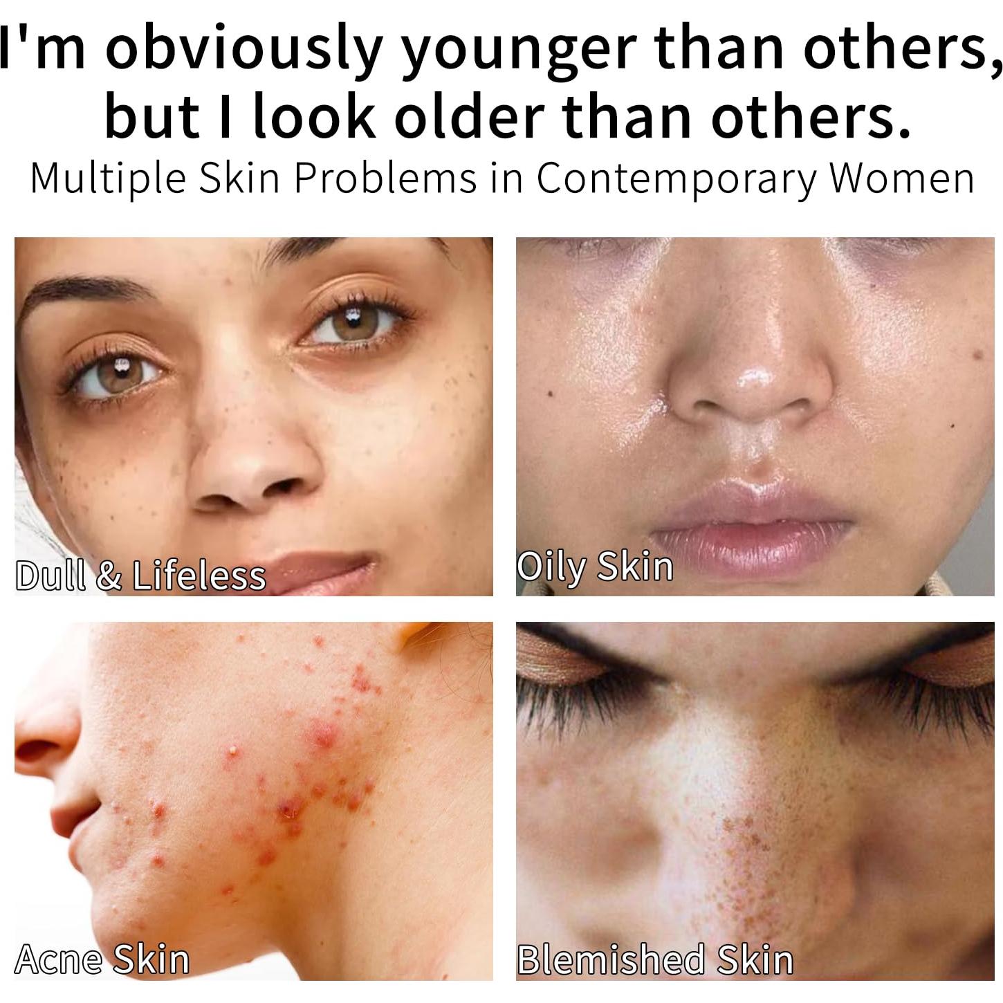 Suero de Vitamina C en Barra MISSEDSEN - 5 Piezas 28.35 g