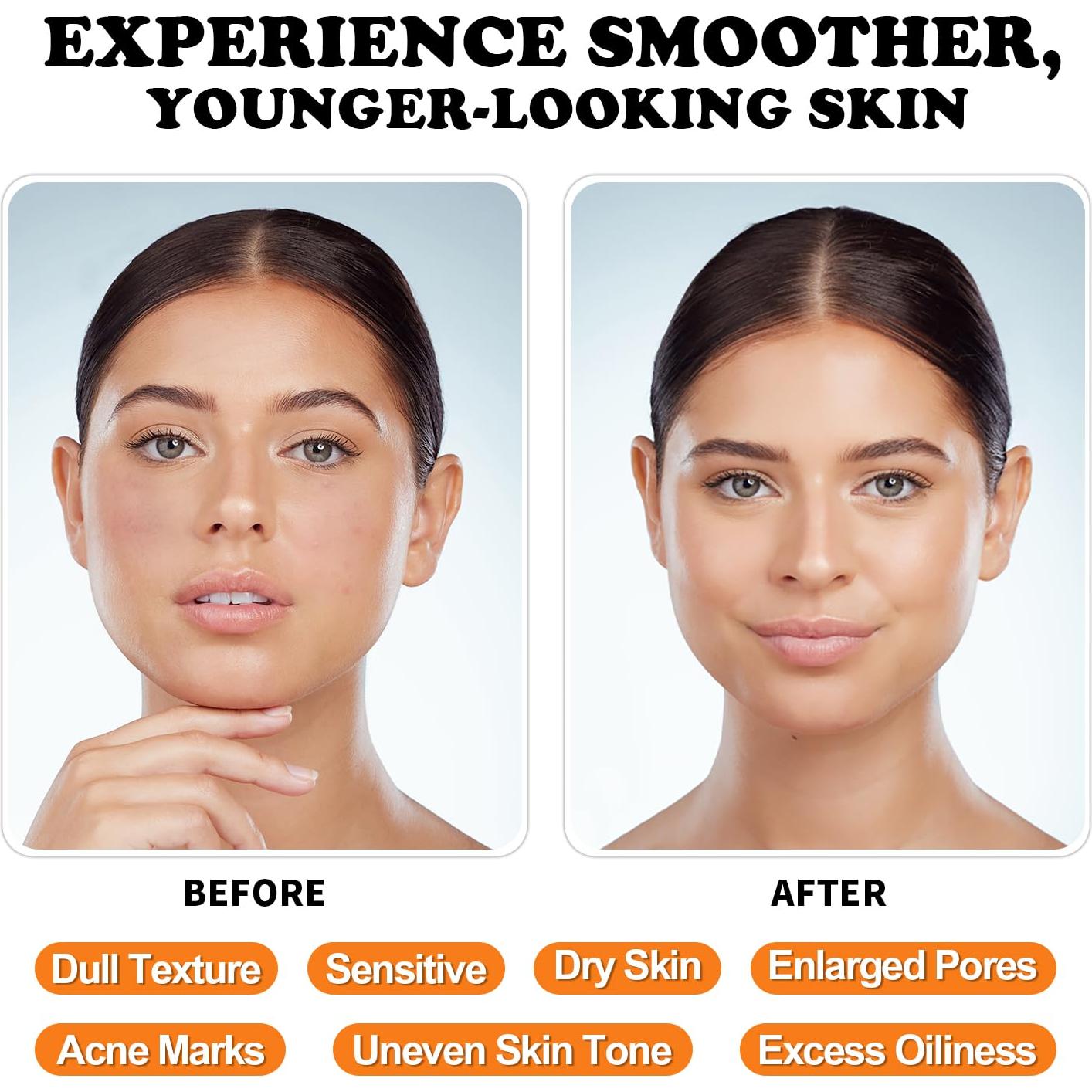 Suero de Vitamina C en Barra MISSEDSEN - 5 Piezas 28.35 g