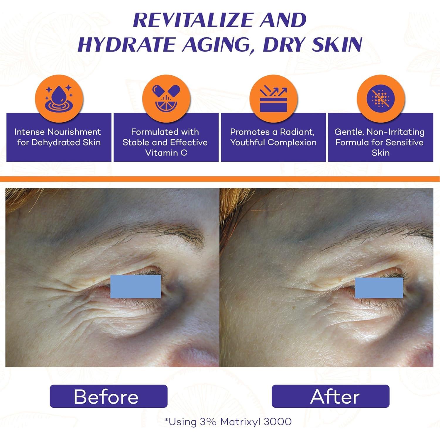 Suero Facial Vitamina C 5% St. Croix - Hidratante 29.57 ml