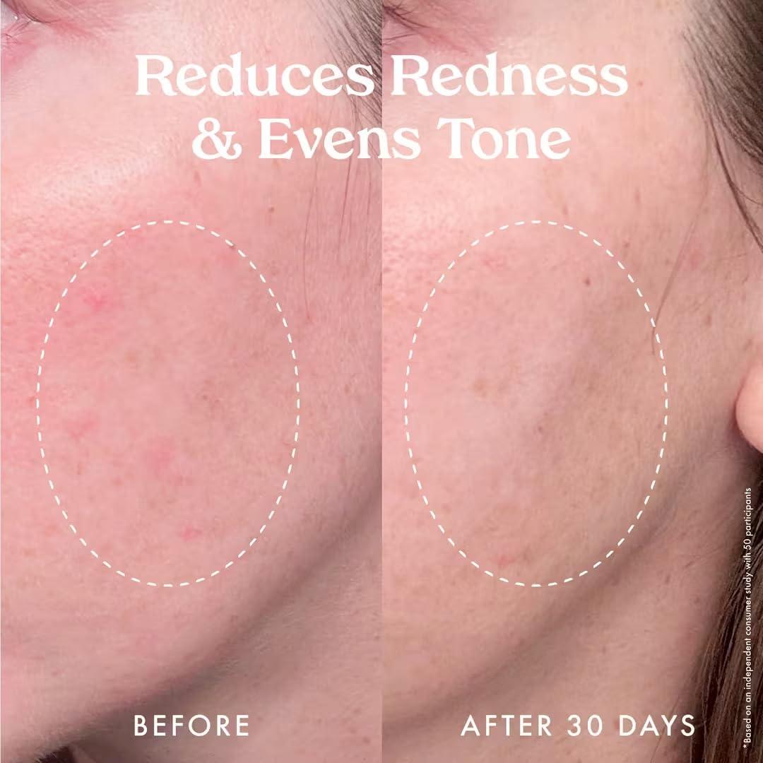 Sérum Corrector de Discoloración Vitamina C Kopari 48g