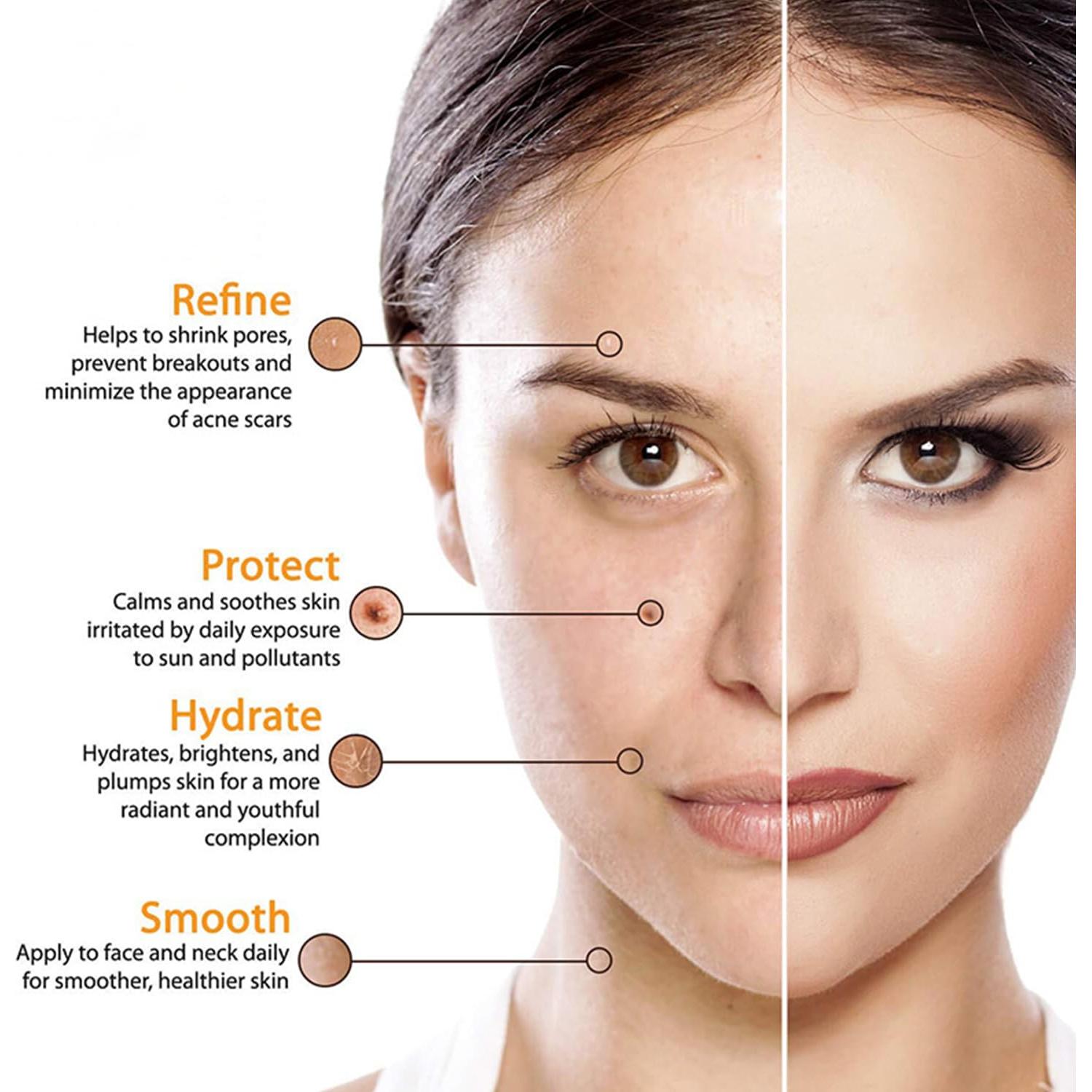 Suero Facial de Vitamina C Carvenchy 30ml Hidratante Antienvejecimiento