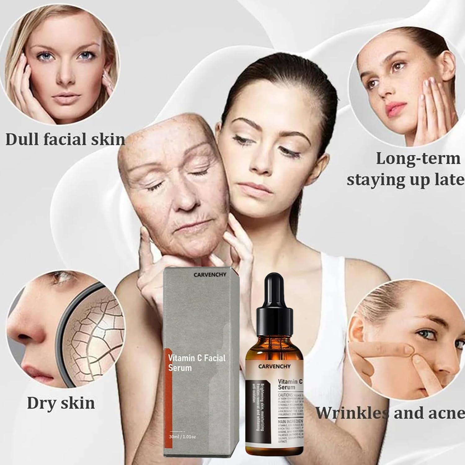 Suero Facial de Vitamina C Carvenchy 30ml Hidratante Antienvejecimiento