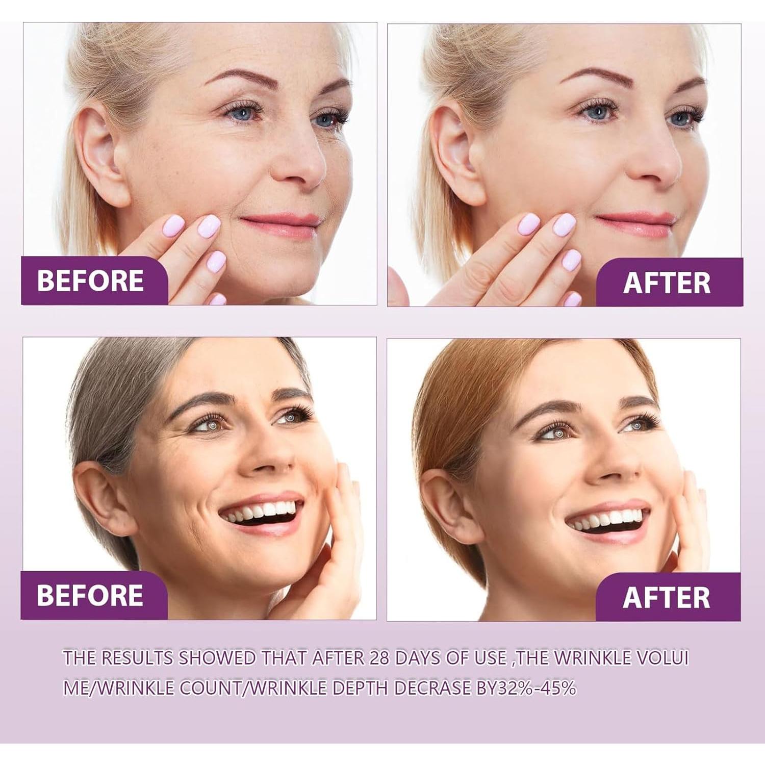 Suero Facial Rejuvenecedor Retinol Venature 2PCS 91g