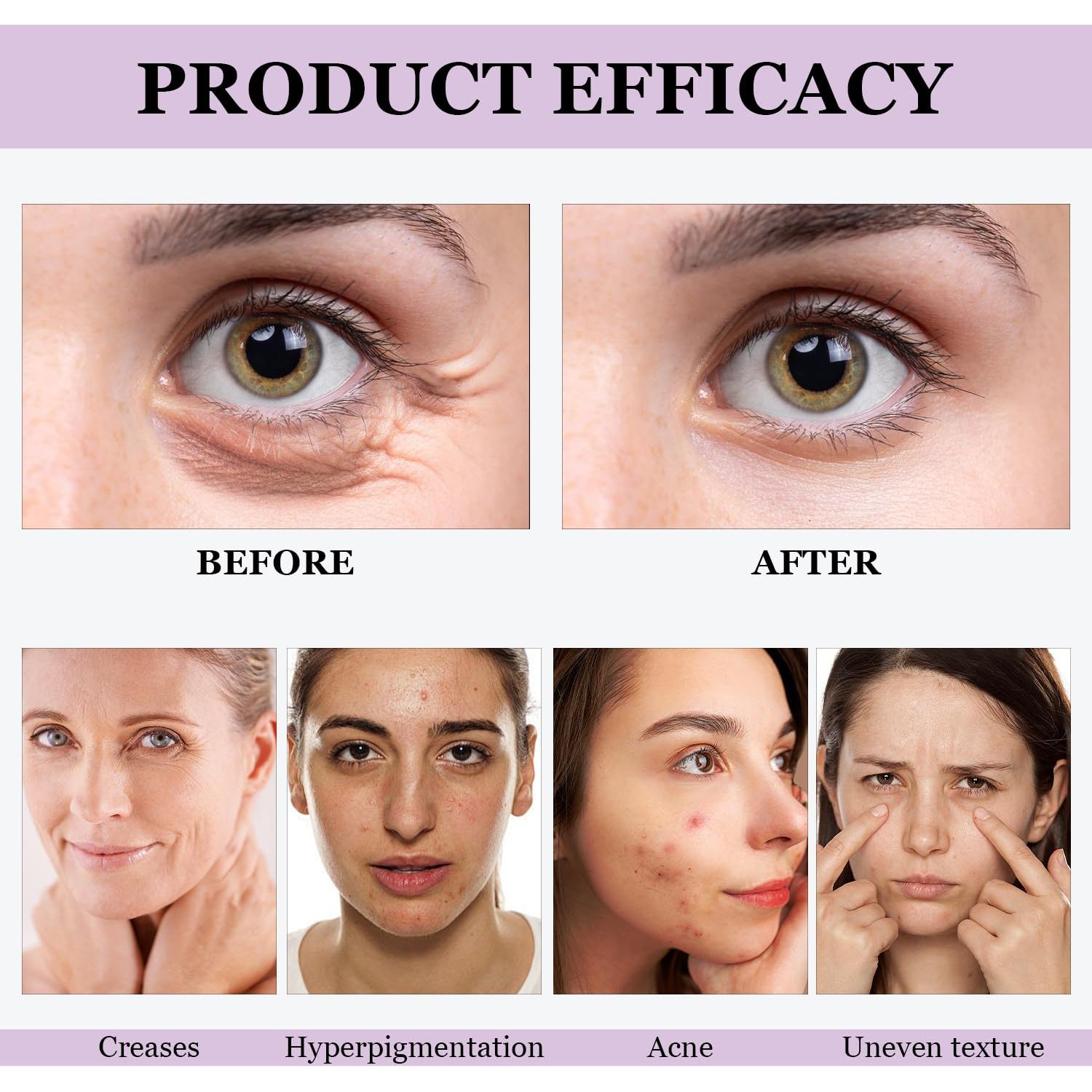 Suero de Retinol y Bakuchiol Venature - 2 Piezas para Arrugas