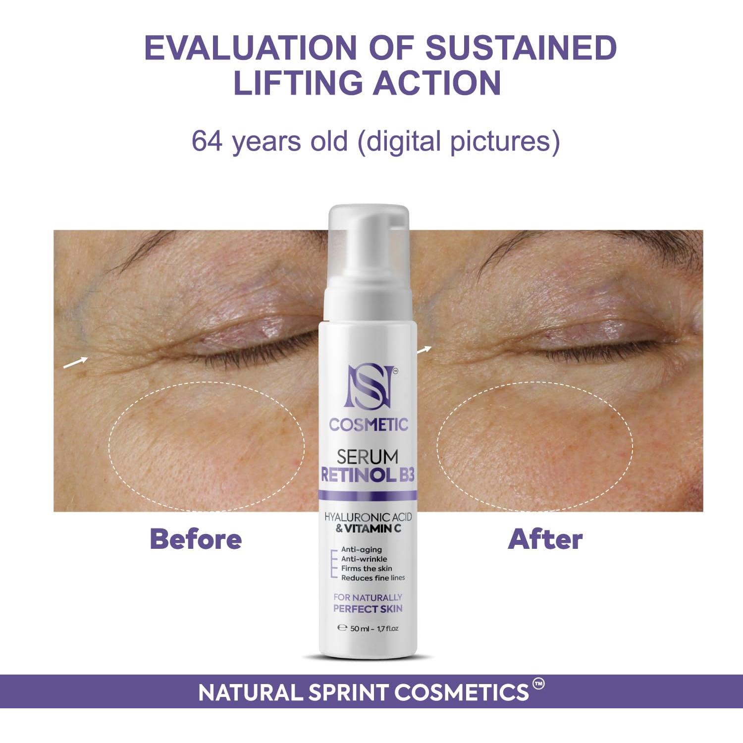 Suero Facial Anti-Envejecimiento Bio Treasure 50ml - Retinol B3, Ácido Hialurónico, Vitamina C