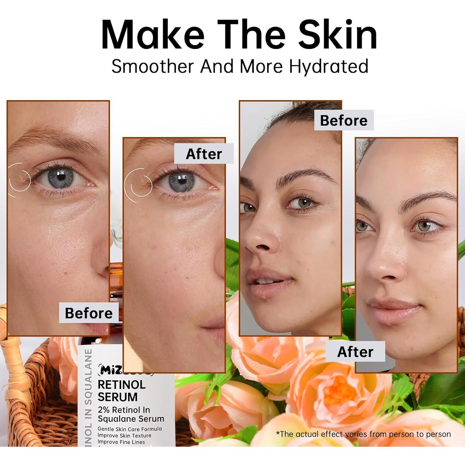 Suero de Retinol 2% MIZEEYE en Escualano 30ml Hidratante